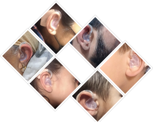 Ear Moulds